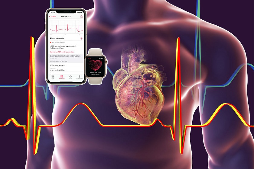 Apple Watch e Salute Cardiaca